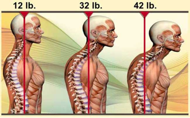 bad posture from playing video games